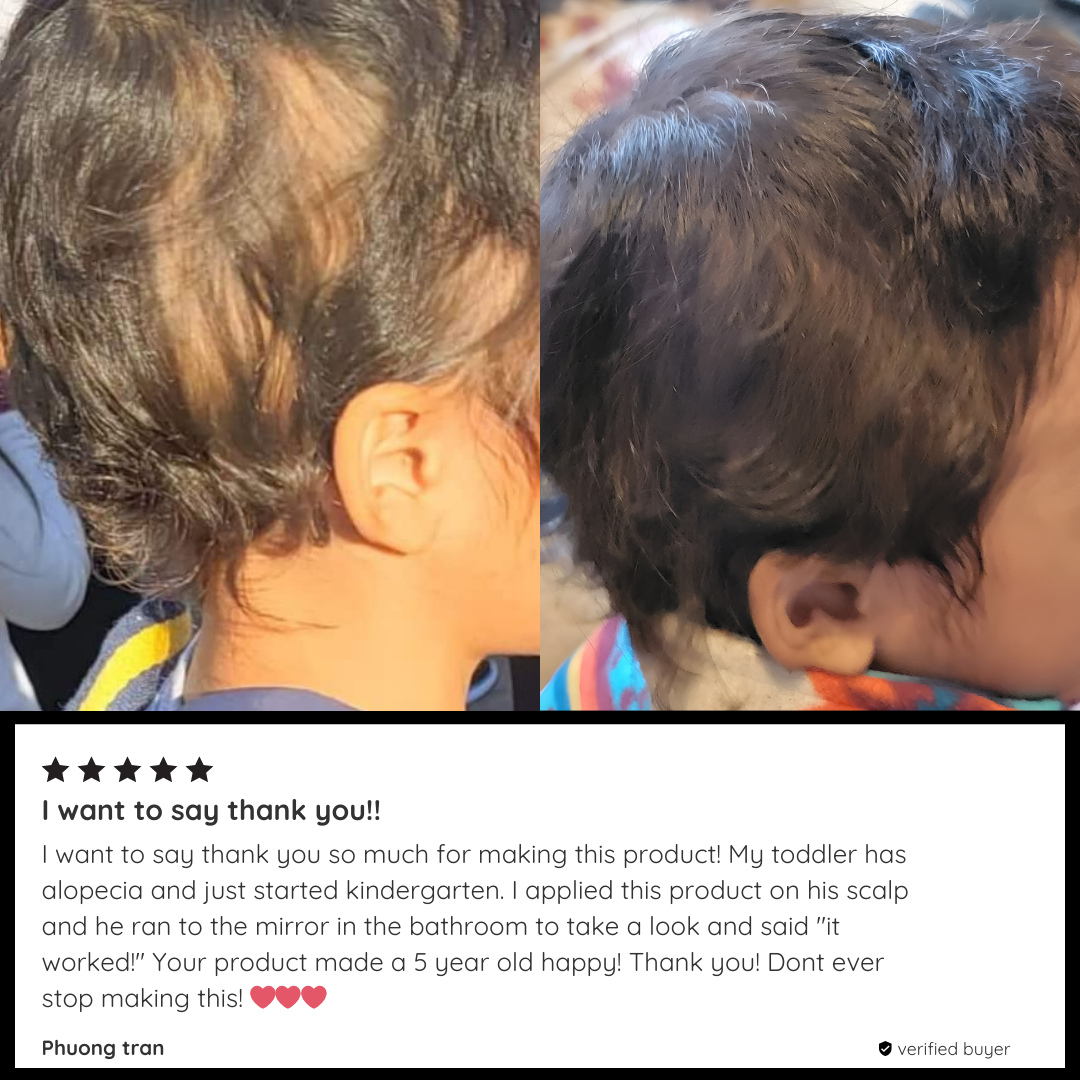 Klynoa Hair Line Powder