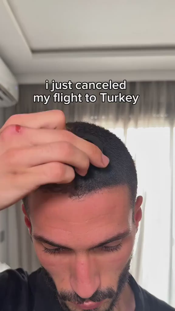 Klynoa Hair Line Powder