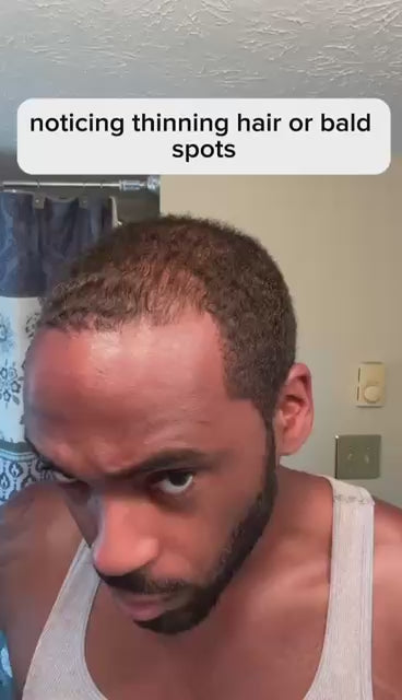 Klynoa Hair Line Powder